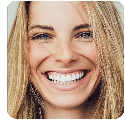 dentasmile pro
